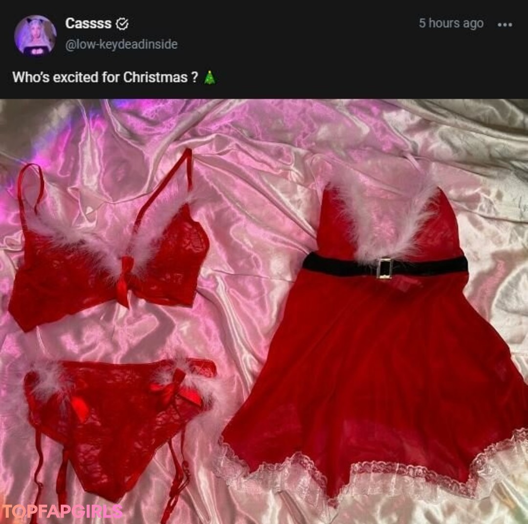 Foto di nudo di fuga di OnlyFans di Cassss #377