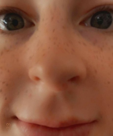Lilhyper