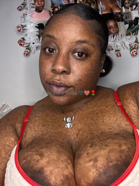 Freckledfantasy5