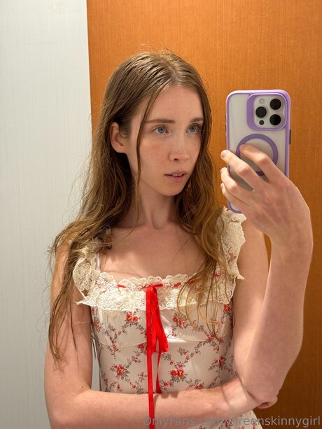 Foto di nudo di fuga di OnlyFans di Eireenskinnygirl