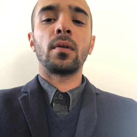 Foto di nudo di fuga di OnlyFans di Marln Tesoro