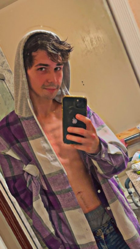 Foto di nudo di fuga di OnlyFans di Ronron