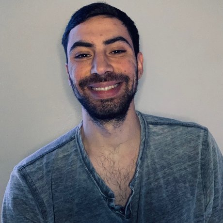 Foto di nudo di fuga di OnlyFans di Jgleeems