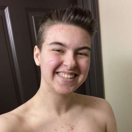 Foto di nudo di fuga di OnlyFans di Rainy