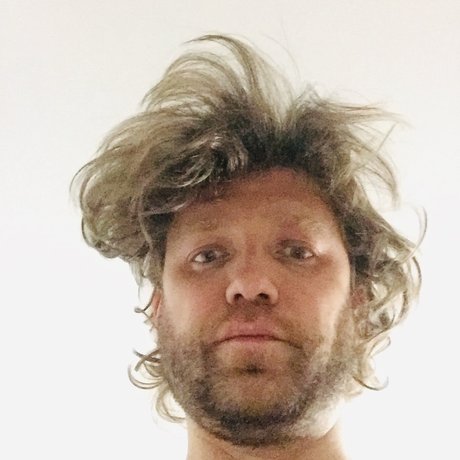 Foto di nudo di fuga di OnlyFans di Toni