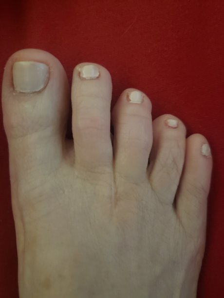 Foto di nudo di fuga di OnlyFans di Sweetfeet