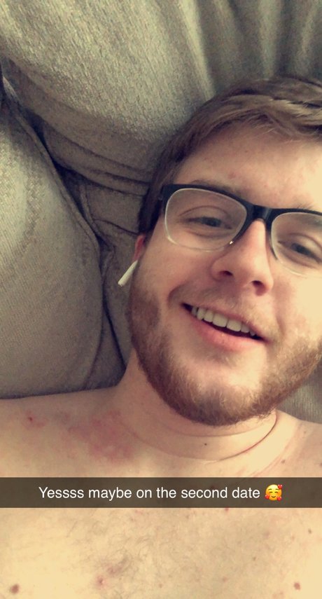 Foto di nudo di fuga di OnlyFans di Pup Chance