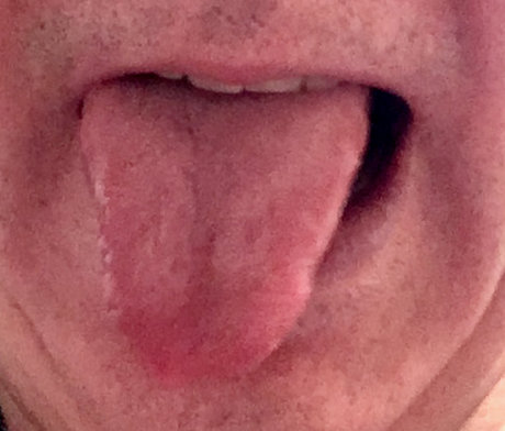 Foto di nudo di fuga di OnlyFans di Dutchboy2540
