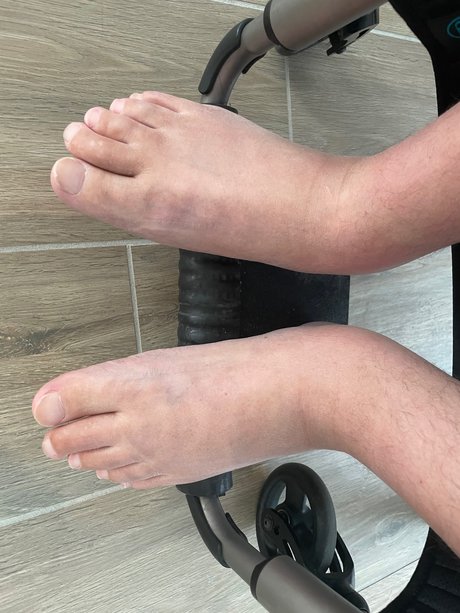 Foto di nudo di fuga di OnlyFans di Parafeet