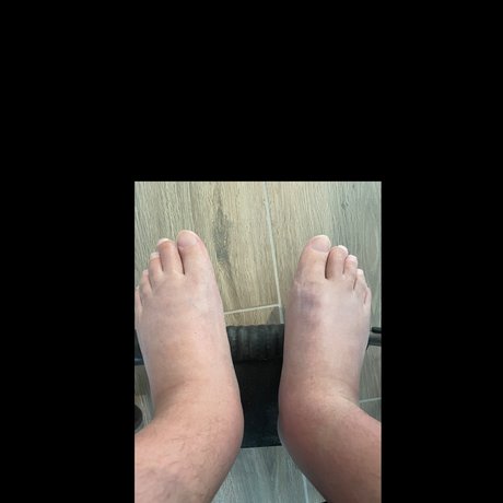 Parafeet
