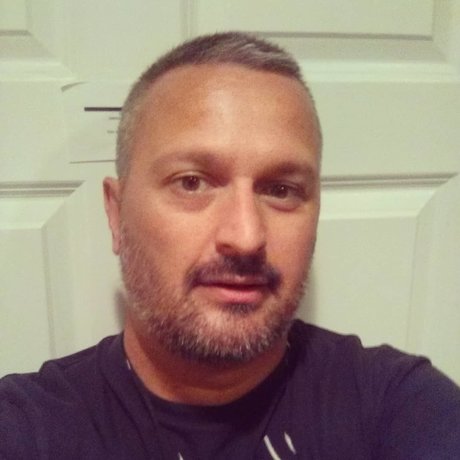Foto di nudo di fuga di OnlyFans di Silverlaketopxx