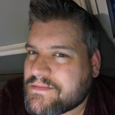 Foto di nudo di fuga di OnlyFans di Solodadxl