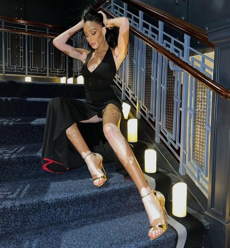Foto di nudo di fuga di OnlyFans di Winnie Harlow