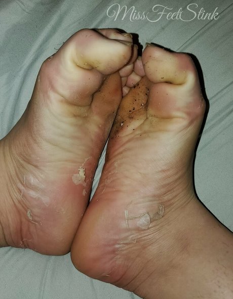 Foto di nudo di fuga di OnlyFans di Missfeetstinkvip