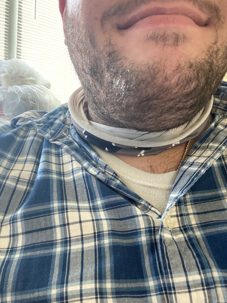 Foto di nudo di fuga di OnlyFans di Fattybear