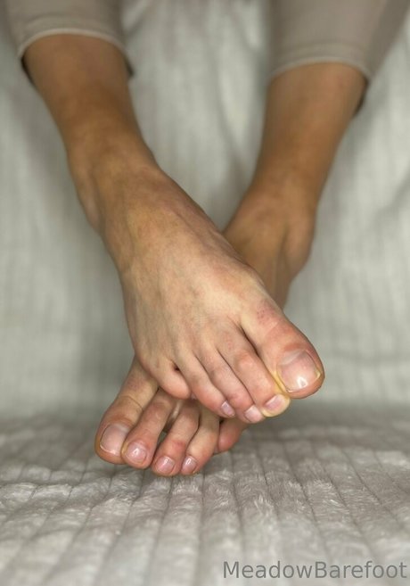 Foto di nudo di fuga di OnlyFans di Meadowbarefoot