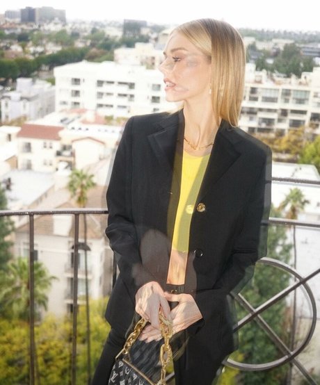 Foto di nudo di fuga di OnlyFans di Samara Weaving