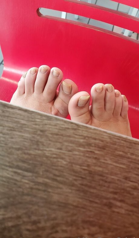 Missfeetstink