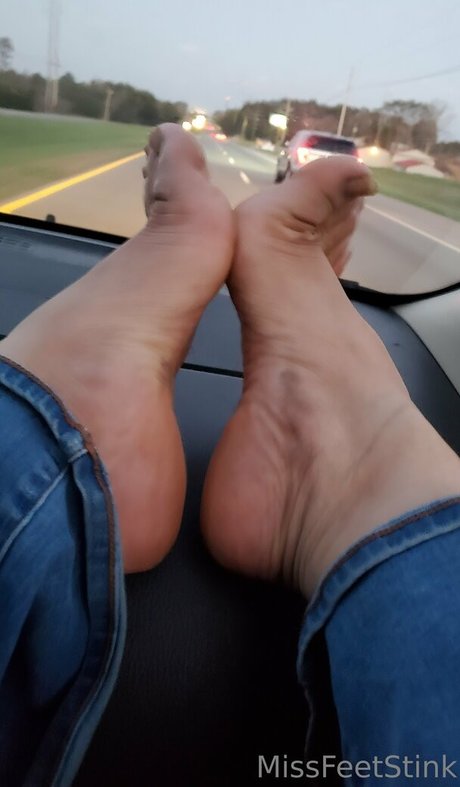 Missfeetstink
