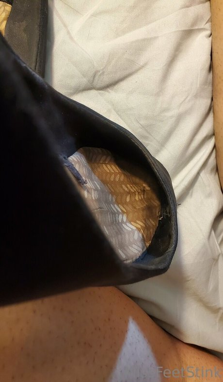 Missfeetstink