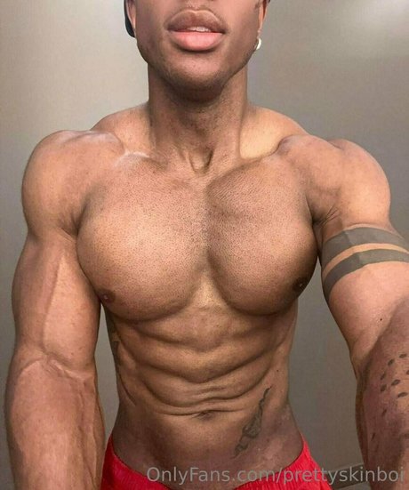 Prettyskinboi