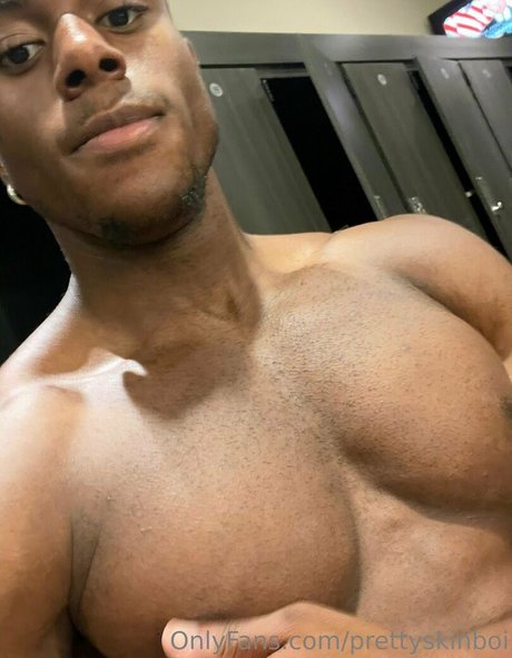 Prettyskinboi