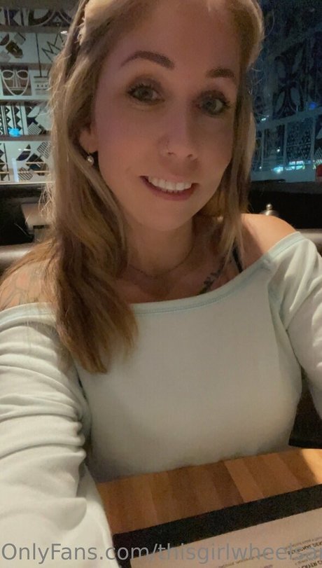 Thisgirlwheelsamputee