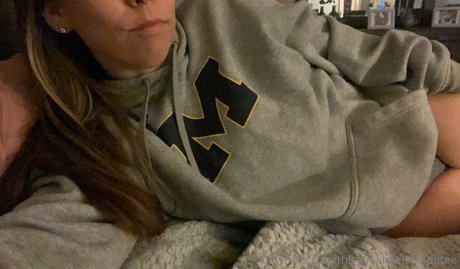 Thisgirlwheelsamputee